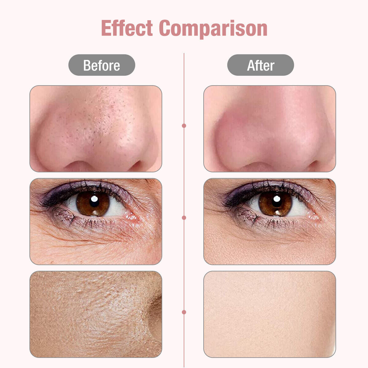 Scrubber ad ultrasuoni per la pulizia profonda del viso peeling pala pulitore dei pori del viso scrubber per la pelle del viso ascensore strumento di bellezza scrubber facciale ad ultrasuoni poro rimozione di comedone spatola spa profonda della pelle