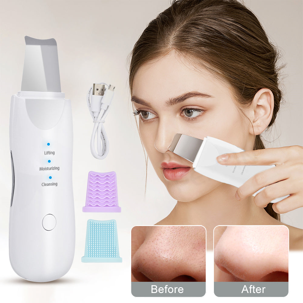 Scrubber ad ultrasuoni per la pulizia profonda del viso peeling pala pulitore dei pori del viso scrubber per la pelle del viso ascensore strumento di bellezza scrubber facciale ad ultrasuoni poro rimozione di comedone spatola spa profonda della pelle