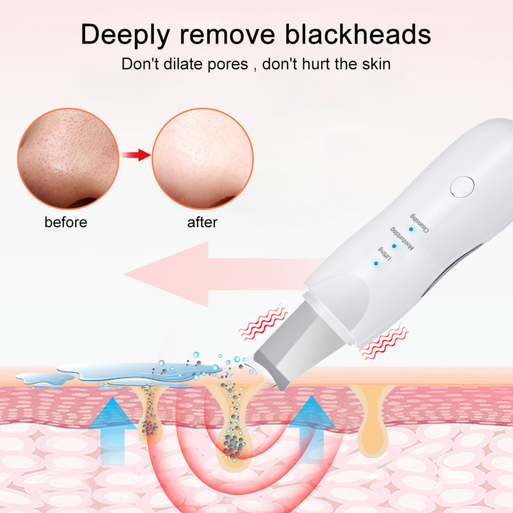 Scrubber ad ultrasuoni per la pulizia profonda del viso peeling pala pulitore dei pori del viso scrubber per la pelle del viso ascensore strumento di bellezza scrubber facciale ad ultrasuoni poro rimozione di comedone spatola spa profonda della pelle